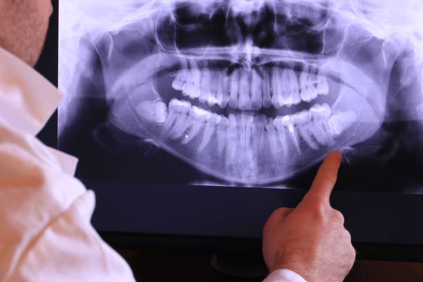 Best Walk-In Emergency Dentist in China Grove, TX