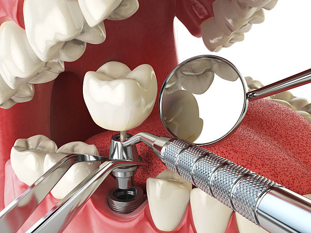 Best Emergency Broken Tooth Repair in China Grove, TX